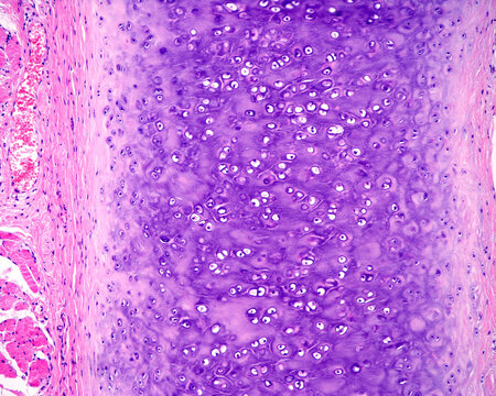 Auricle. Elastic cartilage