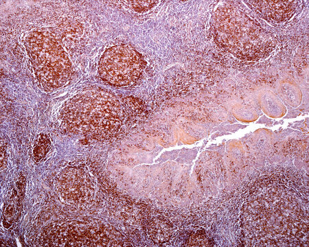 Human palatine tonsil. B-lymphocytes