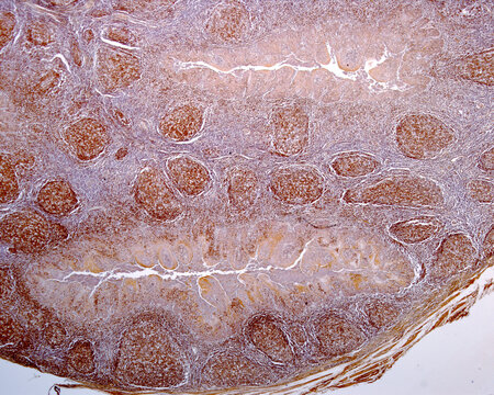 Human palatine tonsil. B-lymphocytes