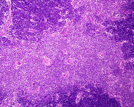 Thymus. Cortex and medulla