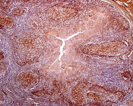 Human palatine tonsil. B-lymphocytes