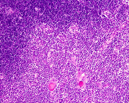 Thymus medulla. Hassall&rsquo;s corpuscle