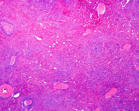 Human spleen