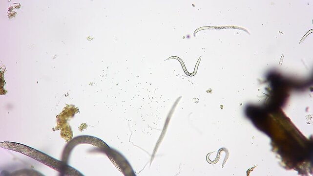 Multiple nematode roundworms wriggling through organic detritus under 100x brightfield microscopy