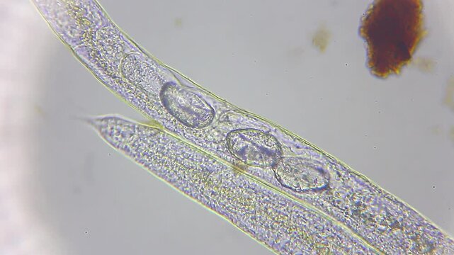 Nematode roundworm body structure with visible internal eggs under 400x brightfield microscopy magnification