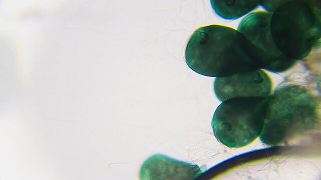 Close-up of Stentor coeruleus ciliates attached to substrate under 100x brightfield microscopy magnification