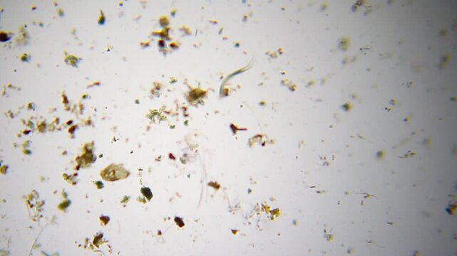 Nematode worm moving through organic detritus and sediment particles under 100x brightfield microscopy