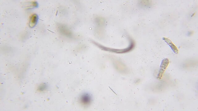 Nematode worm wriggling among swimming rotifers in liquid medium under 100x brightfield microscopy