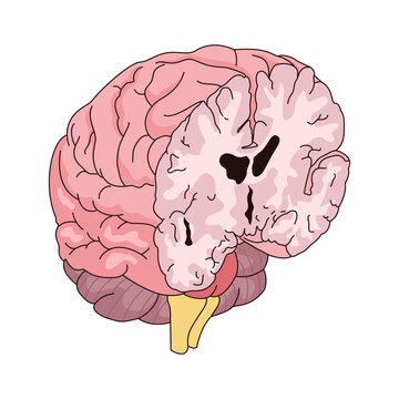 Human Brain Cross Section Anatomy Vector Illustration