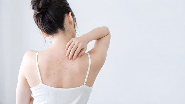 背中ニキビと肌荒れを気にする若い女性の後ろ姿