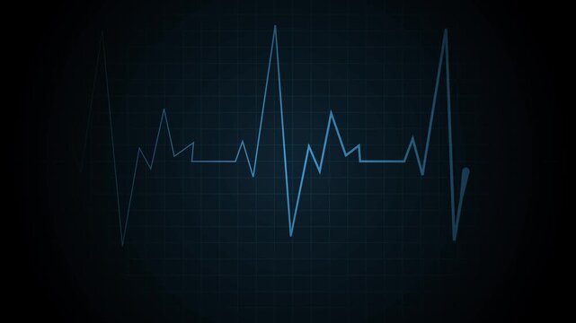 Abstract heart rate line grid with a single pulse spike medical monitor style animation