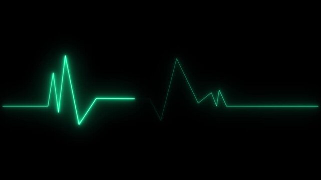 Glowing neon green heart rate signal line on digital medical monitoring equipment screen
