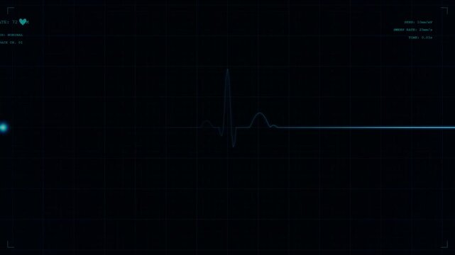 Medical electrocardiogram ecg heart monitor shows normal heart beat rhythm pulse motion on a dark digital display screen footage.