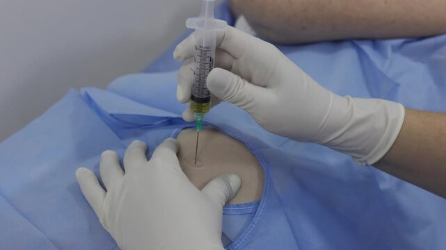 Close-up of a healthcare professional administering a platelet-rich plasma (PRP) injection using a syringe and needle. The procedure represents regenerative medicine, aesthetic treatment