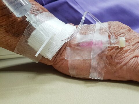 Close view of intravenous therapy secured to an elderly patients hand medical tubing dressing adhesive tape during hospital care