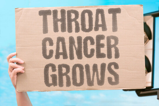 "Throat cancer grows" Oropharyngeal malignancy represents a serious complication pathway. ONCOLOGY. COMPLICATION. CANCER. THROAT. DISEASE.