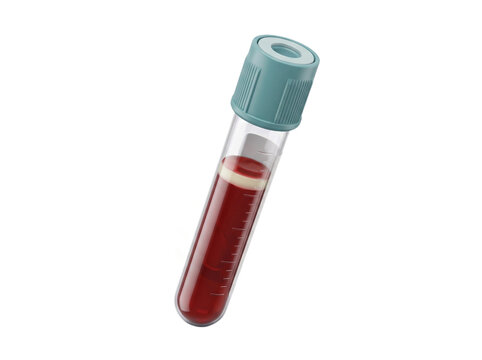 Empty plastic specimen container for medical urine analysis