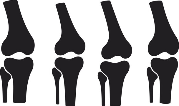Human knee joint bone silhouette icon set, orthopedic medical anatomy and joint pain vector illustrations