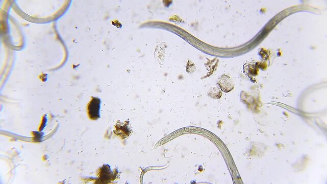 Nematode roundworms wriggling through dirty water with organic detritus under 100x brightfield microscopy