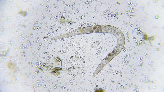 Nematode roundworm with internal eggs visible inside its body under 100x brightfield microscopy