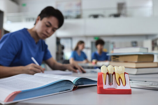 Anatomical dental implant model on an open textbook with an Asian student writing in a library background. Dental implantology and prosthodontics study