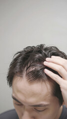 Fototapeta premium Desperate Japanese Young man looking at severe hair loss with disappointed expression, Copy space on the top, Diagonal Aerial view, Vertical image