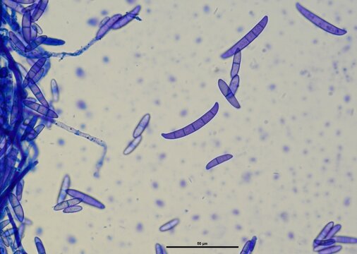 soil microorganisms under a microscope including amoeba, flagellates, nematodes, fungi, bacteria	