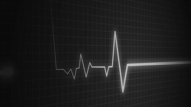 Heart beat line on graph paper showing an ecg pattern and medical signal animation