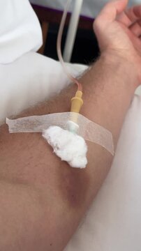 Intravenous catheter attached to arm during IV drip. Concept of putting in IV drip.