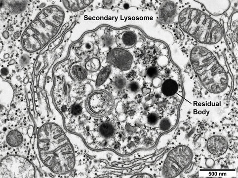 Lysosome with Internal Degrading Material

