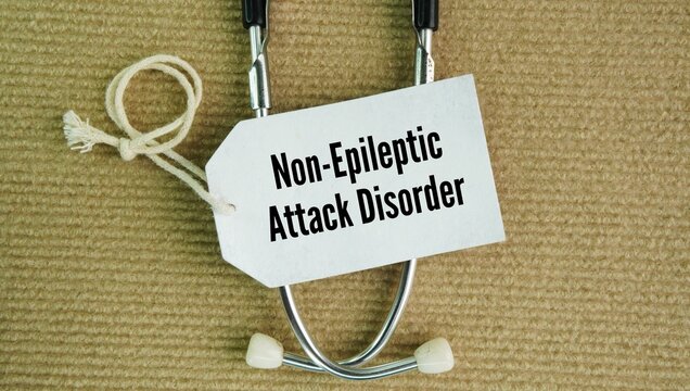 A stethoscope and a paper tag with the words Non-epileptic attack disorder NEAD. condition causing seizure-like episodes that are not driven by abnormal electrical brain activity like epilepsy.