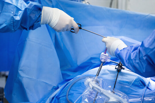Gloved Surgical Team Exchanging Laparoscopic Instrument