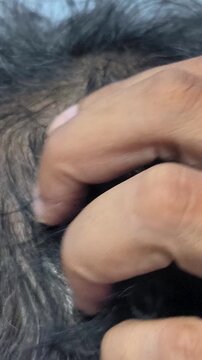 Extreme close up of middle aged man scalp showing gray thinning hair and bald spot as symbol of aging