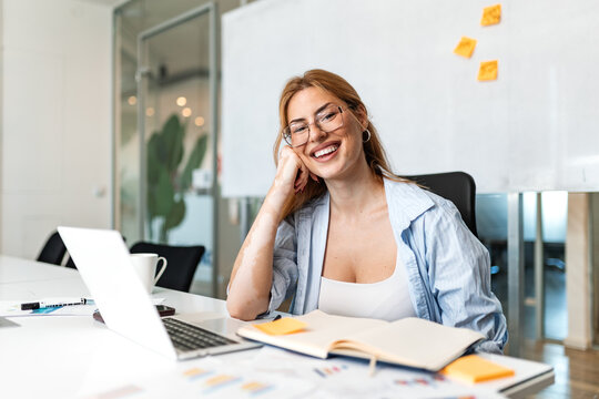 An attractive young businesswoman with red hair and glasses, showing vitiligo on her arm, smiling warmly at the camera while sitting at her office desk with a laptop and notebook.