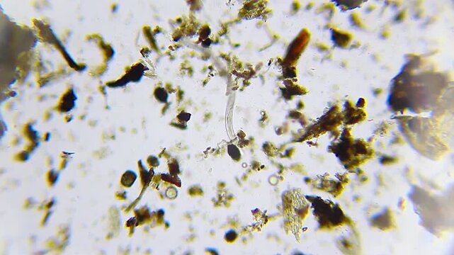 Nematode roundworm moving through heavy organic detritus and sediment particles under 100x brightfield microscopy