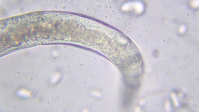 Extreme close-up of a large nematode body structure and internal organs under 400x brightfield microscopy