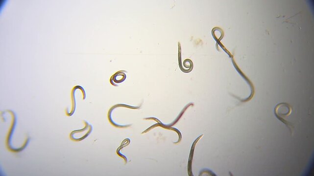 Nematode roundworms wriggling in a liquid drop under 40x brightfield microscopy