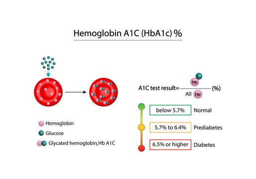 Hemoglobin A1C, HbA1c test , HbA1c levels, Glucose sticks to hemoglobin, glycated hemoglobin, up to 120 days. A1C Blood Sugar Test, Diabetes Mellitus, Infographic, Vector illustration.