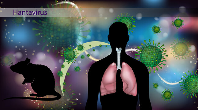 Hantavirus Infection Transmission from Rodents to Humans and Lung Disease Illustration. Hantavirus Pulmonary Syndrome with Rodent Vector and Human Respiratory System