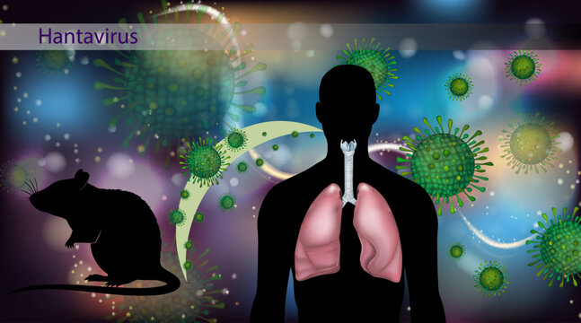 Hantavirus Infection Transmission from Rodents to Humans and Lung Disease Illustration. Hantavirus Pulmonary Syndrome with Rodent Vector and Human Respiratory System