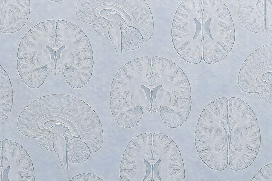 Medical background featuring detailed human brain cross-sections embossed like subtle anatomical watermarks on a soft blue-gray textured surface, conceptual neurology and neuroscience design.