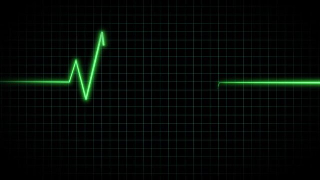 Green flatline medical EKG screen, heart failure and patient's death on ECG monitor, resuscitation of a patient with a heart attack on ECG monitor on black background. 4k video