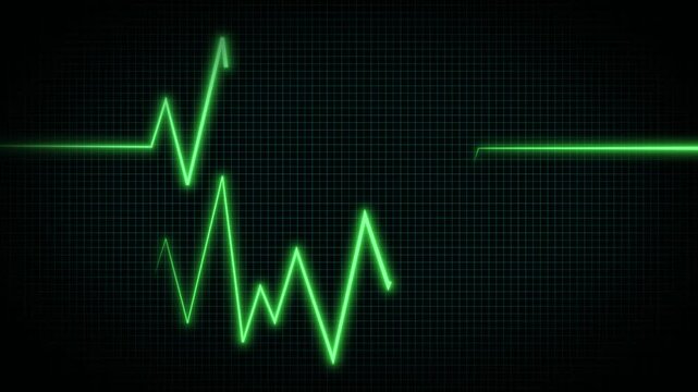 Green flatline medical EKG screen, heart failure and patient's death on ECG monitor, resuscitation of a patient with a heart attack on ECG monitor on black background. 4k video