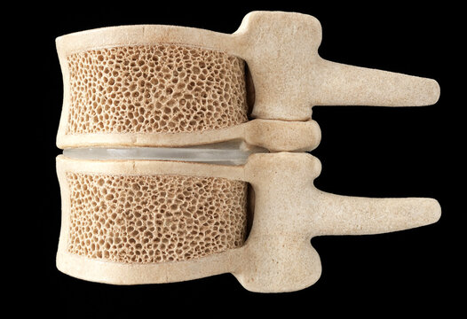 Detailed view of two vertebral bodies with porous trabecular bone structure