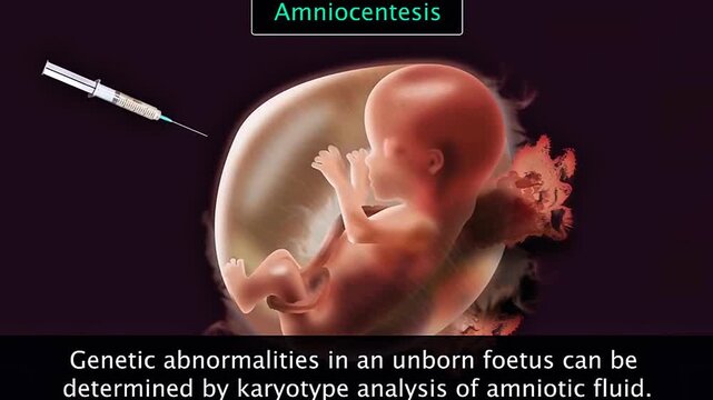 Medical illustration of ultrasound-guided amniocentesis for prenatal testing and fetal health assessment.