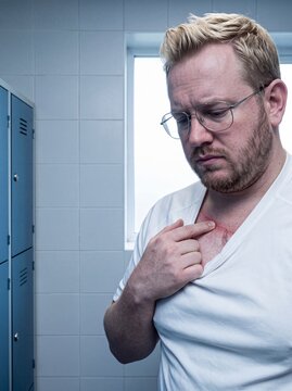 R&ouml;tlicher Hautausschlag auf der Brust in der Umkleidekabine