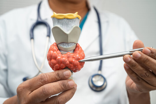 Hyperthyroidism, Overactive Thyroid, Thyroid Lymphoma, Asian doctor with thyroid gland human anatomy model in hospital.