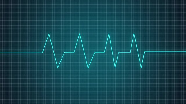 Heartbeat waveform animation pulses rhythmically on a medical grid. Hospital cardiogram monitor telemetry traces the waveform. Vital patient pulse rate data drives the heartbeat waveform.