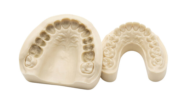 Dental plaster cast of human teeth, orthodontic gypsum mold for prosthetic dentistry, anatomical stone model of upper and lower jaw on white background