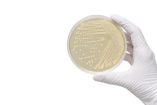 Gloved scientist holding a Petri dish with bacterial colonies growing on agar, isolated on a clean white background with copy space for microbiology, laboratory research, clinical testing, and biotech
